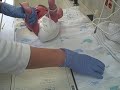 Baby Victoria getting her Footprints