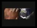 Microdermabrasion: Discovery Health interviews