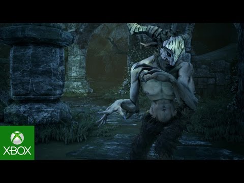 Immagine anteprima YouTube