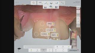 Thinking of purchasing an oral scanner?
