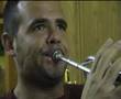 2Trumpetist and embouchure dystonia. Trompetista y distonía