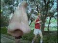 Runny Nose