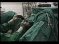 TURP (Transurethral Resection of the Prostate)