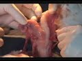 The Uterine Transplant Procedure