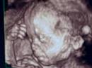 baby-parker-in-3d.html