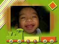 In Memory of aldrei ..thank you(a baby with Pachygyria)