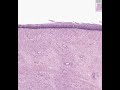 Shotgun Histology Vagina