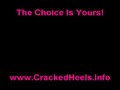 Cracked Heels
