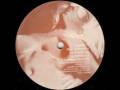 Vince Watson - Subversion