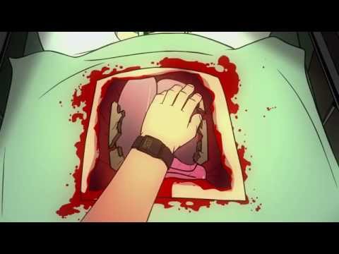 Mondo Guest Pass: Surgeon Simulator Animated - Heart Transplant