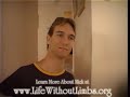livingwithoutlimbs