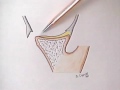 Movie 5 Diagonal path