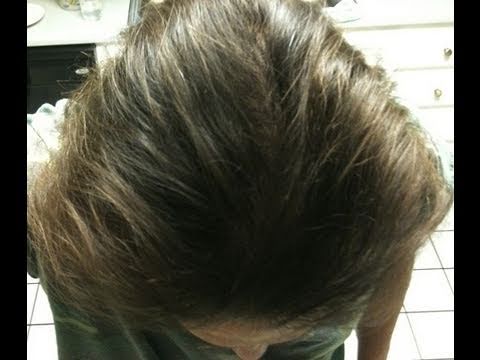 how to grow side hair