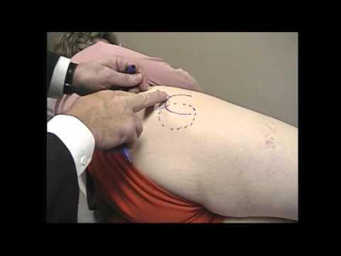 how to locate greater trochanter
