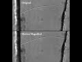 A new hearing mechanism