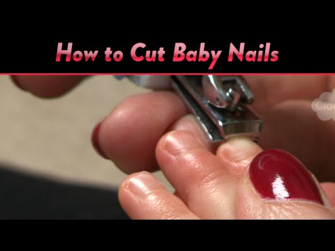 how to unclog tear duct in baby