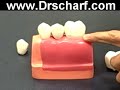 Dental Implants|Long Island Suffolk County Babylon Periodontist Dental Implants|Long Island Suffolk County Babylon Periodontist
