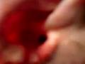videos de Re: Front flip into a dive gone wrong