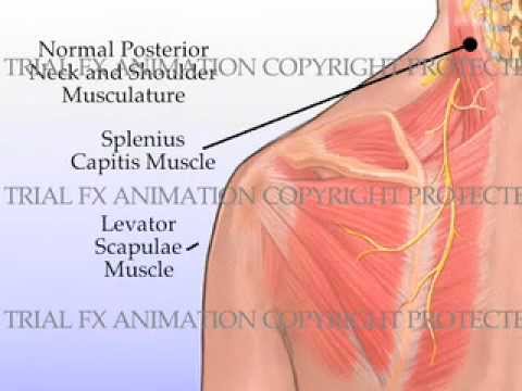 how to relieve occipital pain