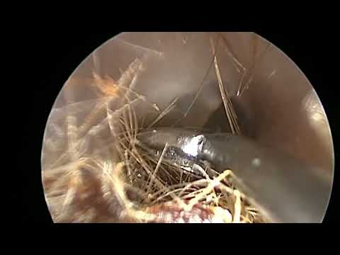 video-img