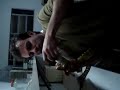 Acidentes com animais peçonhentos ( Jararaca) Caratinga