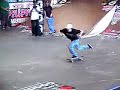 Ryan Sheckler Gettin a Concusion