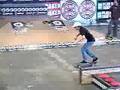 Ryan Sheckler Gettin a Concusion