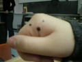 pubic lice