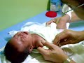 2nd vaccine of BCG 2nd vaccine of BCG