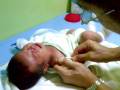 videos de 2nd vaccine of BCG