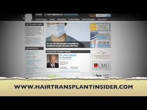 how to sleep after hair transplant