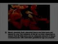 Suction & Curettage Abortion Illustrated / Vacuum Aspiration Abortions / Video
