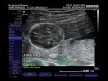 � MENINAAAA! 23/11/09