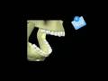 Movimiento Mandibular