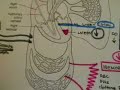 Hypovolemic shock 3 Hypovolemic shock 3