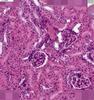 Shotgun Histology Kidney