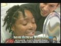 Dr. Bill Dorfman's Highlight Reel: Dramatic Dental Makeovers