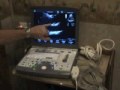 Academy of Ultrasound, LLC Video II.avi