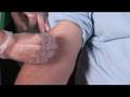 Healthy Skin Care : How to Get Rid of Stretch Marks for Free