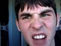 life as a retarded chipmunk