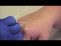 Learning to start an IV It's big fun, and a bloody mess, when a group of students learn to use needles for the for the first time...On each other!