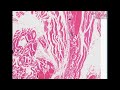 Histopathology Skeletal muscle--Trichinosis Histopathology Skeletal muscle--Trichinosis