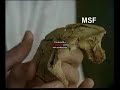 atapuerca: gran dolina