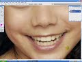 Simple Photoshop Techniques, Part One- Whitening Teeth Simple Photoshop Techniques, Part One- Whitening Teeth