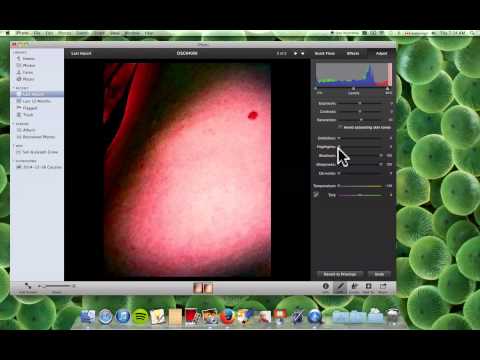 how to get rid of mri dye