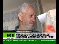 Children - victims of war in Ossetia Children - victims of war in Ossetia