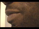 The Acne Practice (Home Version 3) The Acne Practice (Home Version 3)