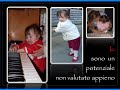 Down syndrome:&nbsp;S�ndrome di Down: Micol
