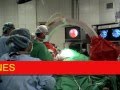 TUMOR DE HIPOFISIS Resección endoscópica