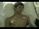 blakes pectus surgery 2